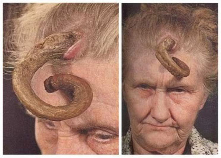 genetic conditions horn