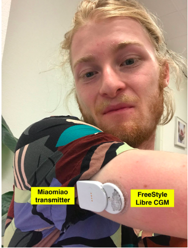 Software Engineer with Diabetes Incredibly Builds His Very Own Artificial Pancreas Software Engineer with Diabetes Incredibly Builds His Very Own Artificial Pancreas