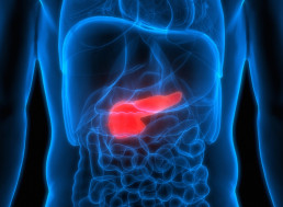 Software Engineer with Diabetes Incredibly Builds His Very Own Artificial Pancreas