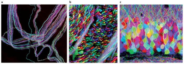 Incredibly Trippy 'Brainbow' Imagery Is Helping Doctors to Treat Tumors Incredibly Trippy 'Brainbow' Imagery Is Helping Doctors to Treat Tumors