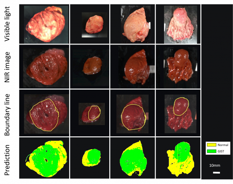 tumors-resize_md Tumors Resize MD