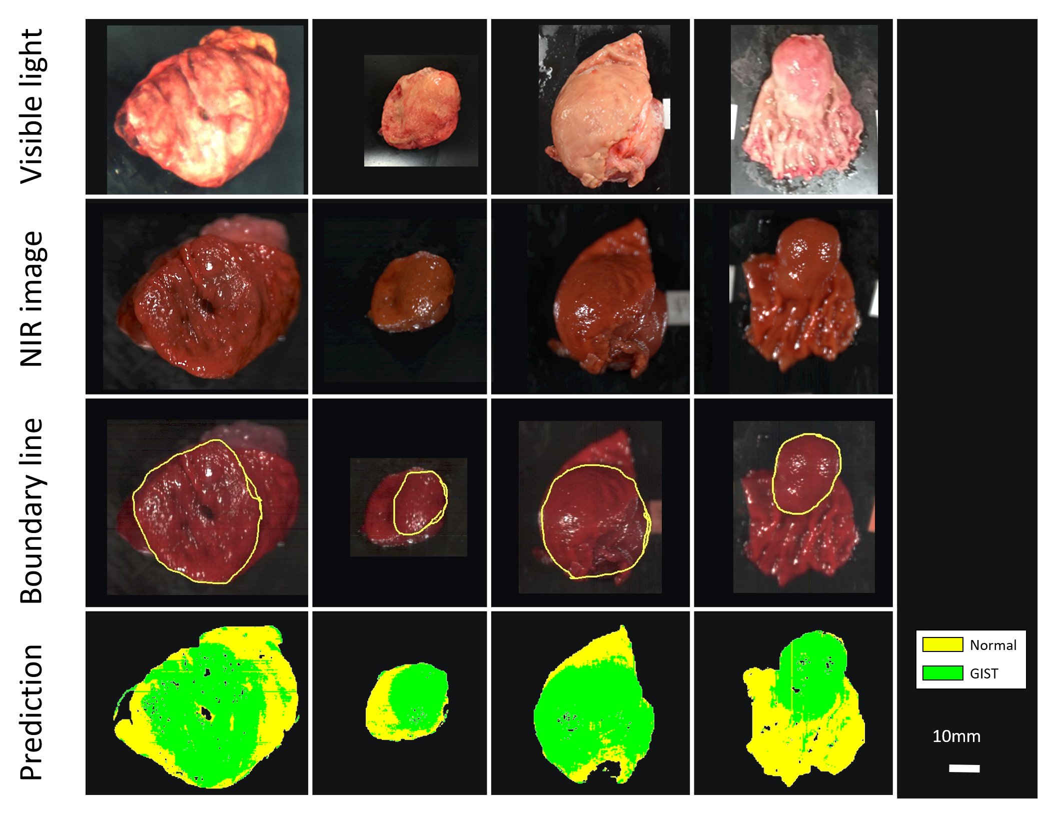 tumors-resize_md Tumors Resize MD