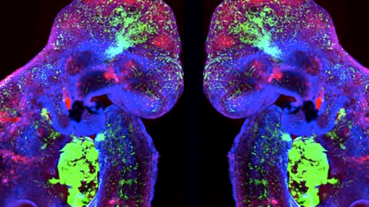 A New Finding Brought Us Closer to Cultivating Human Organs In The Lab