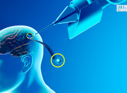 What We Know So Far About Elon Musk’s Neuralink