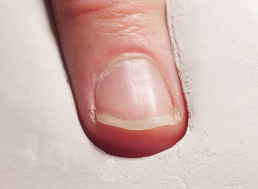 Time-Lapse Footage of a Fingernail Growing and Getting Trimmed for One Year
