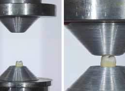 YouTuber Measures the Exact Force That Human Tooth Can Take